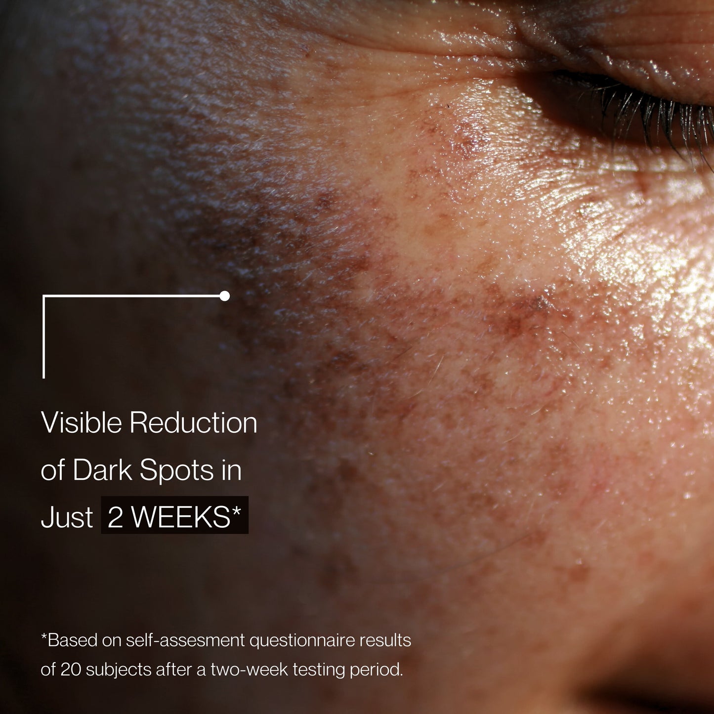 8X Active Brightening Complex